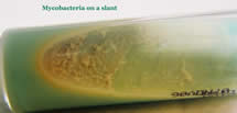 Mycobacteria